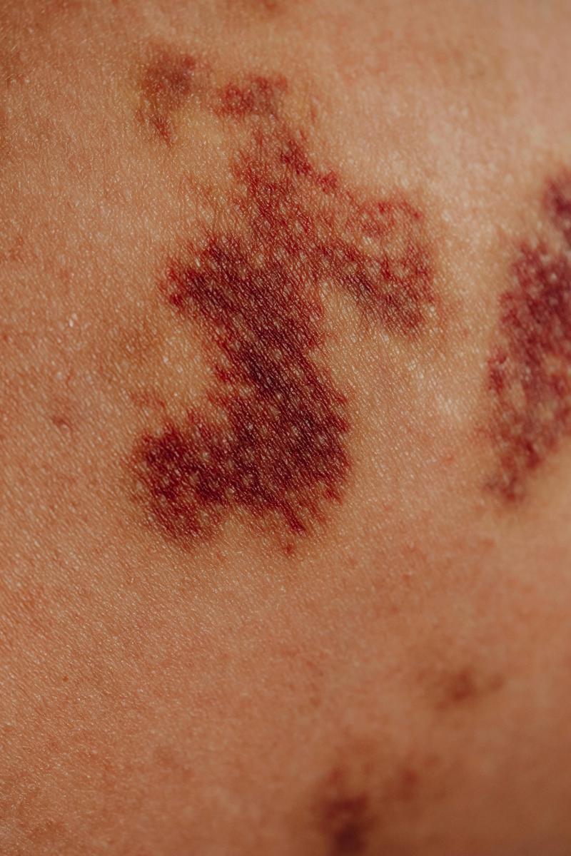 Liver disease-5580dc51ebd9485a9c3a1e9618bcf9dd.jpg Liver disease
