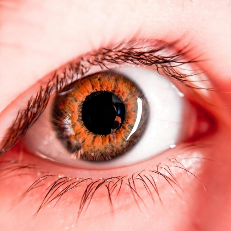eye-health-c82afdd8e4a646c292a99219c0d03e78